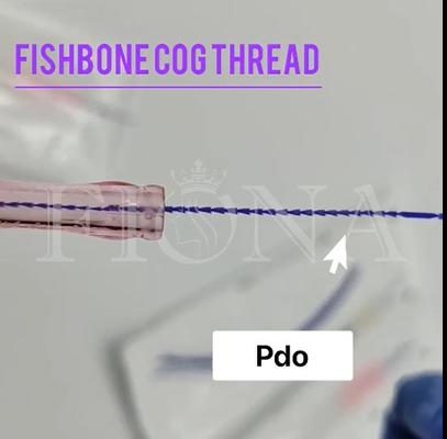 Fishbone PDO φορμάροντας νήμα βαραίνω για το βραχίονα ελέγχου ματιών προσώπου που ανυψώνει 18G100MM